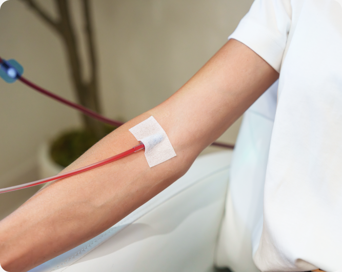 Close-up of a patient's arm with an EBO2 line and dressing in place