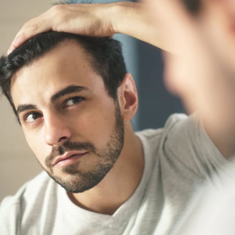 Bearded man examining his hairline with his hand, looking into a mirror