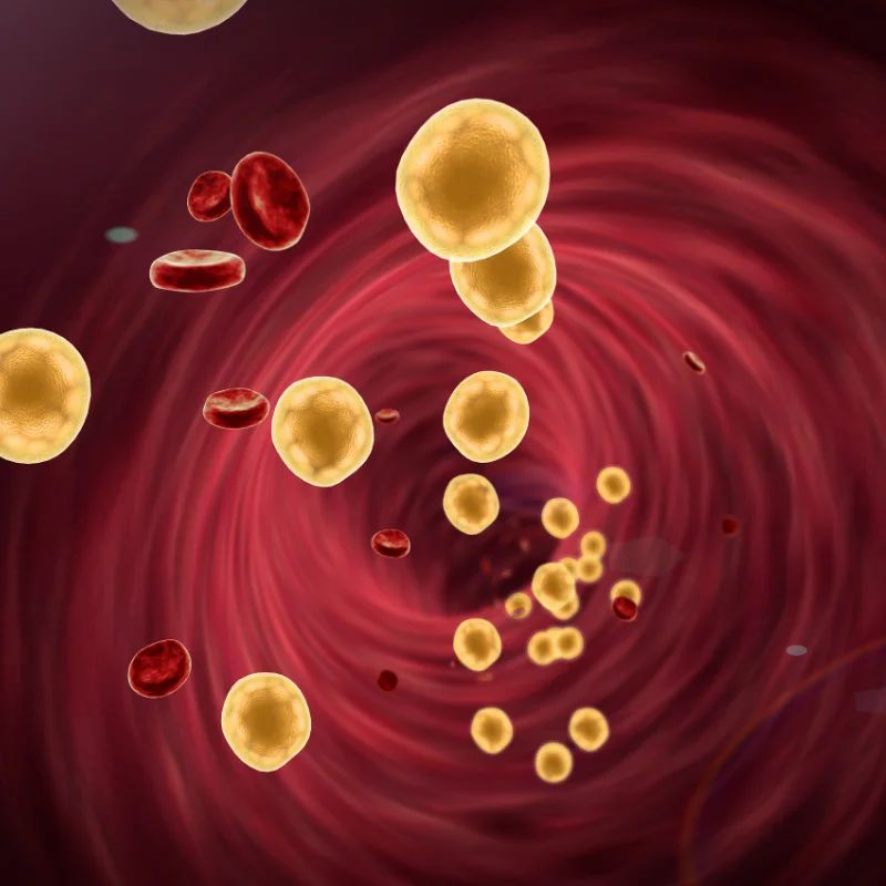 Yellow cholesterol globules and red blood cells flowing through a blood vessel