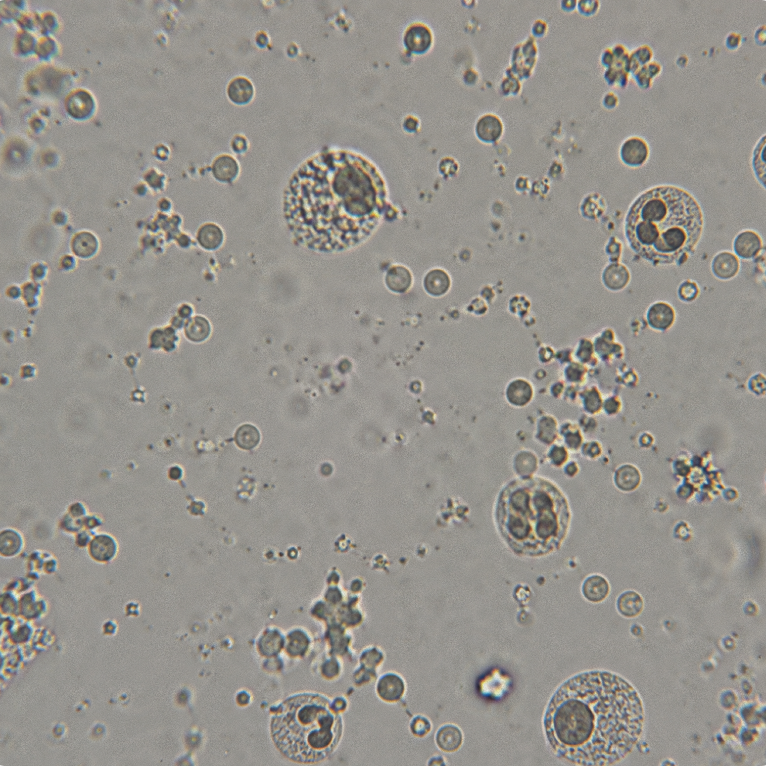 Microscope view of blood cells and plasma