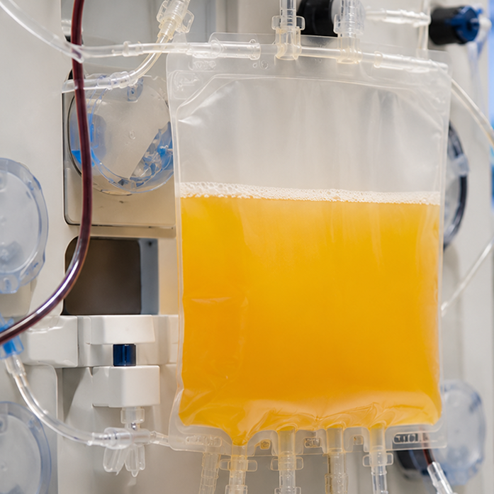 Bag of separated yellow plasma hanging in a clinical filtration setup